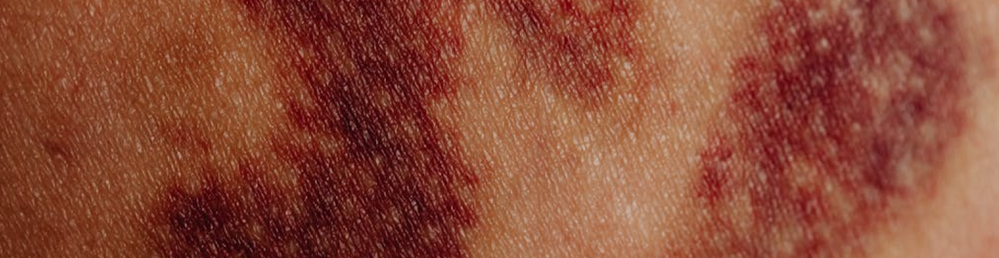 I casi clinici che confermano l’efficacia di PhytoHeal