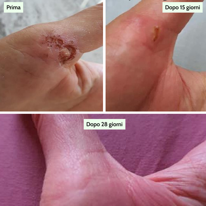 Regenerative Tissue Serum