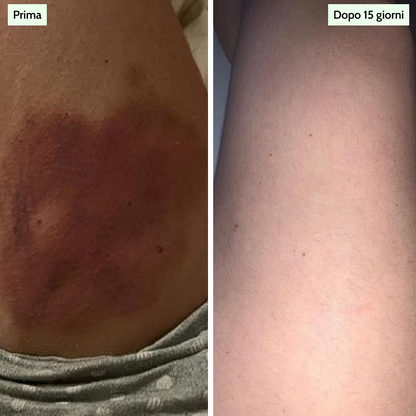 Anti-Inflammatory Serum